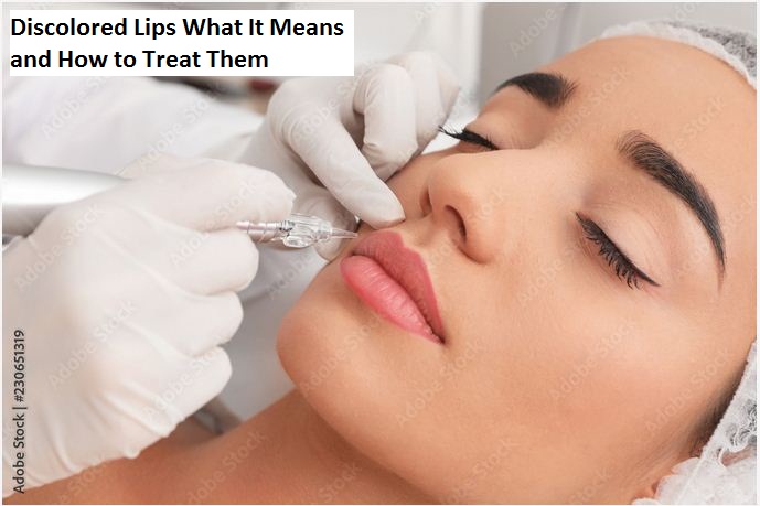 Discolored Lips What It Means and How to Treat Them