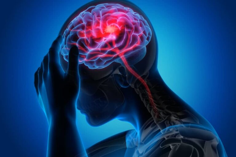 Brain Hemorrhage Recovery Time, Causes, and Symptoms