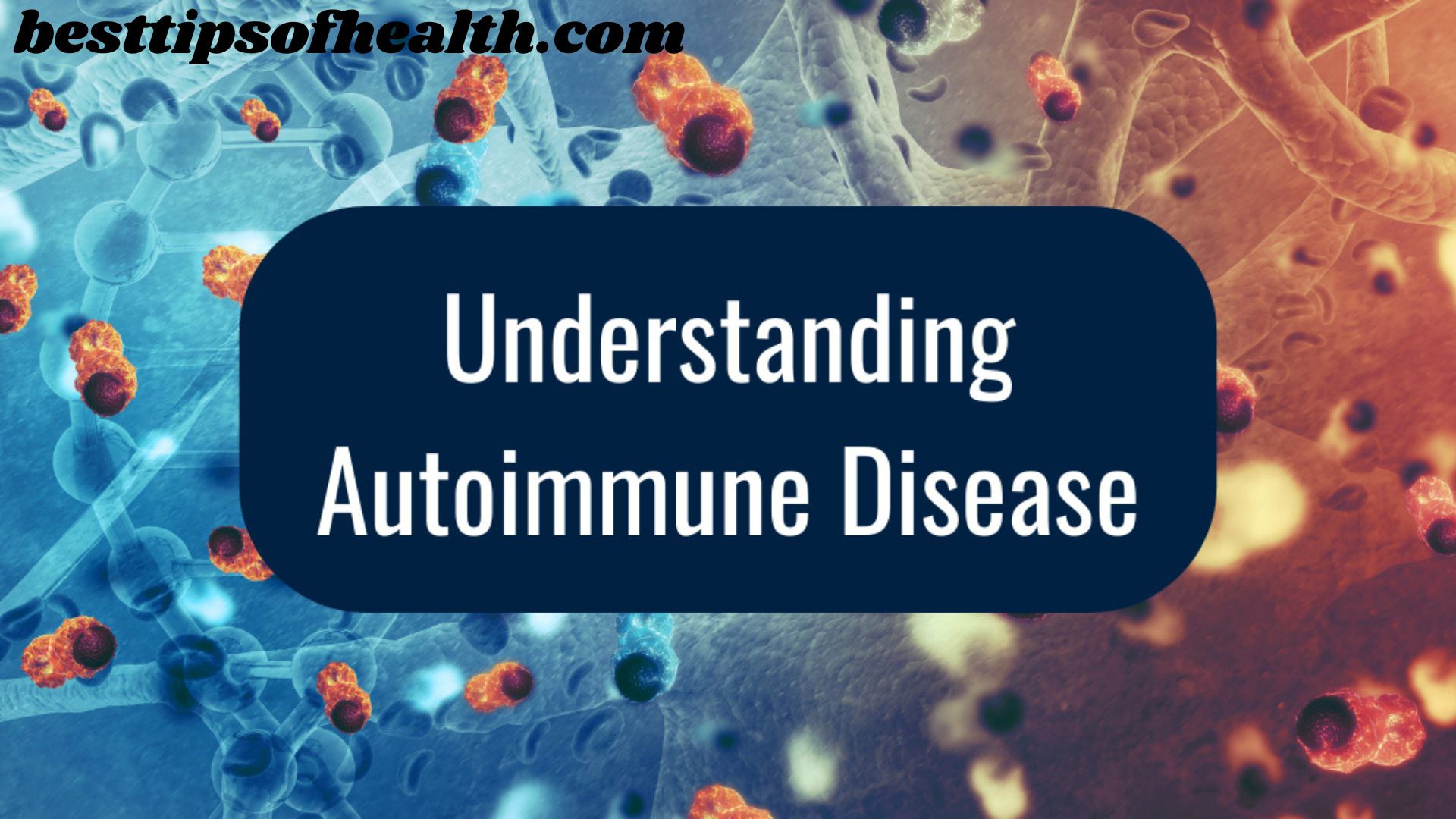 Understanding Rheumatoid Arthritis: Unraveling The Mysteries of a Chronic Autoimmune Disorder